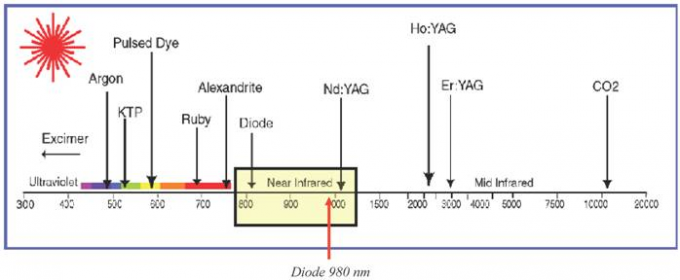 635nm de Rode van de de Spinader van de Diodelaser Pijnloze 30MHZ Hoge Frequentie van de de Verwijderingsmachine