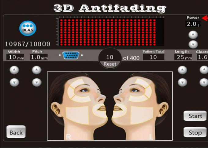 De Faceliftmachine 8 van 20000 Schoten 3D Hifu Patronen met 1-11 Lijnen