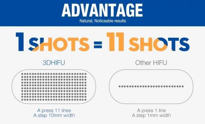 4MHz 11 Lijnen Draagbare Hifu de Faceliftbehandeling van Machine/20000 Schoten 2D Hifu