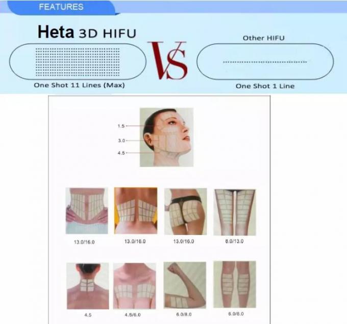 de Huid van 150VA Hifu het Aanhalen Machine 8 Patronen/Hifu-Vermageringsdieetmachine het 15 Duimscherm