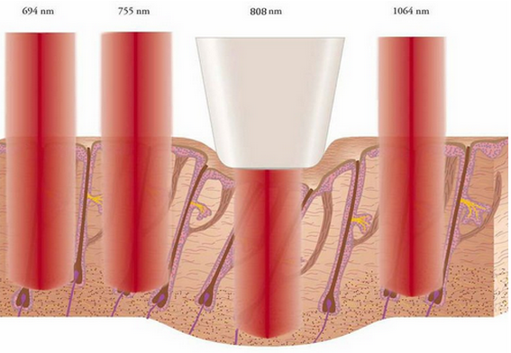 Van de de laserzender van Duitsland van de het Haarverwijdering 808nm het Permanente Systeem van de de Diodelaser